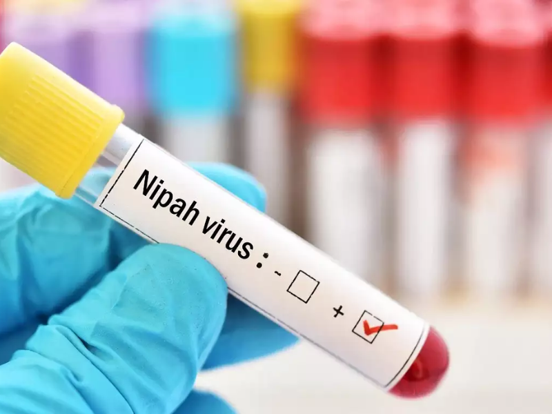 Student Dies Of Nipah Virus In India’s Kerala: Here’s All You Need To Know About The Virus